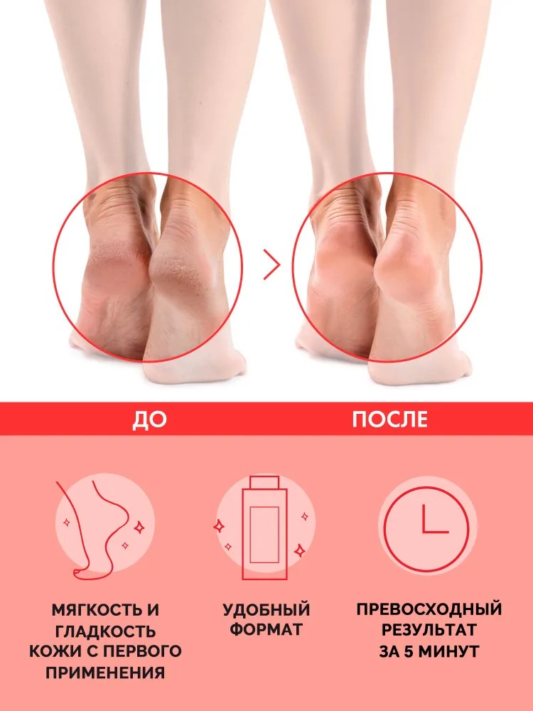 Профессиональный гель для педикюра SUPER ПЯТКИ 250мл