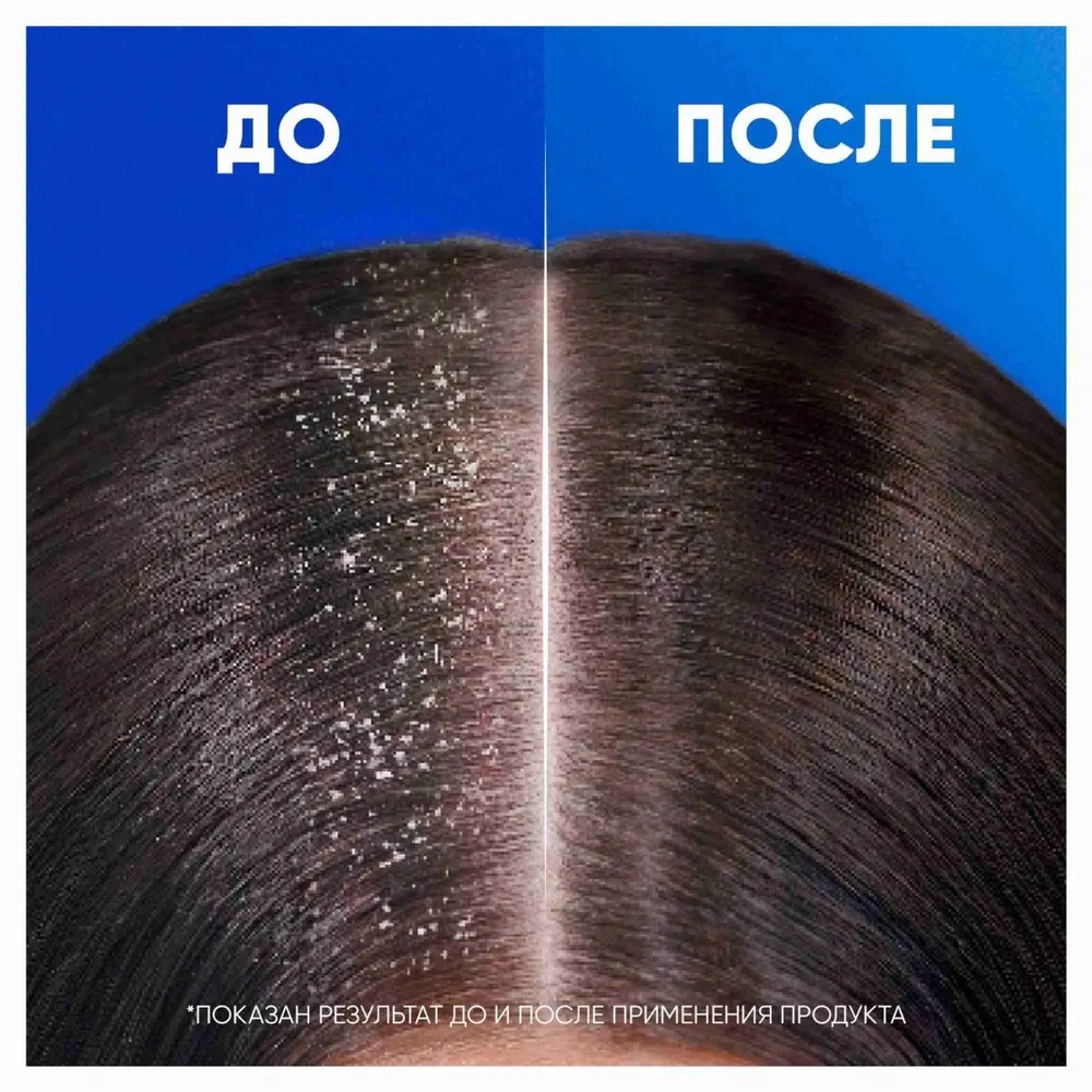 head & shoulders 2в1 шампунь 360/400мл (Цитрусовая свежесть, для жирных волос)