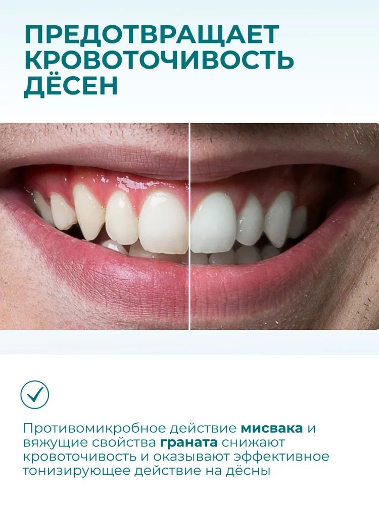 Himalaya since Зубная паста Complete Care Комплексный уход 75мл