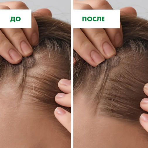 Аптечка Агафьи сыворотка для волос 150мл (для роста волос)